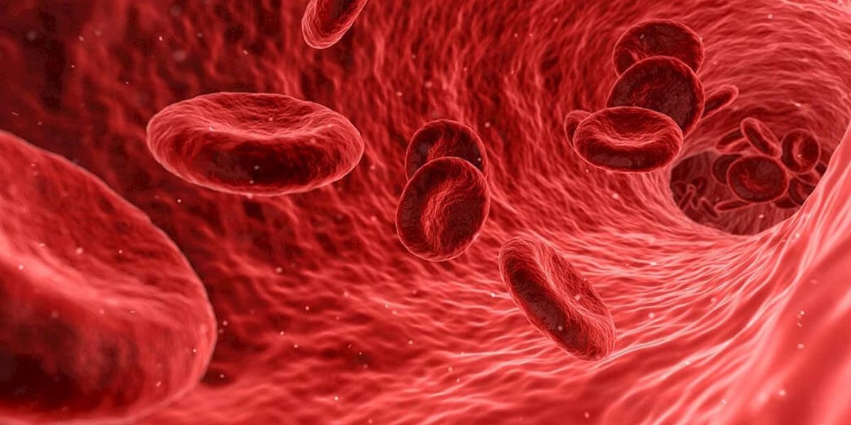 Sickle Cell