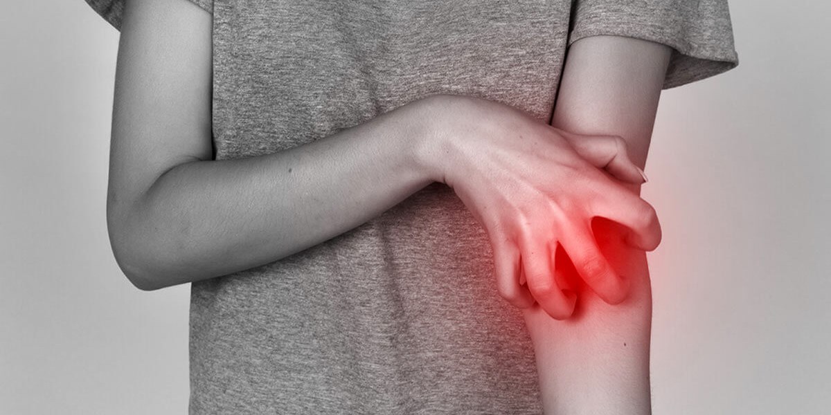 National Eczema Week