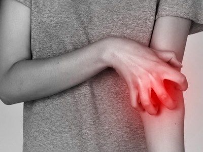 National Eczema Week